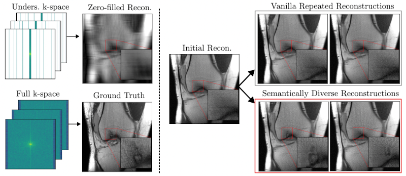 Mind the Detail: Uncovering Clinically Relevant Image Details in Accelerated MRI with Semantically Diverse Reconstructions